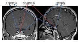 人到中年突然“改头换面”，原是得了“丑病”！ 不仅会影响外貌，更会损害身体健康