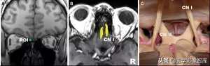 颅神经(12对颅神经解剖及影像)