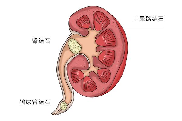 留步！尿完别急着走，小便出现“2色4味”需留意，或是患病征兆