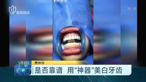 网红牙齿美白“神器”靠谱吗？记者买来网红产品试用告诉你