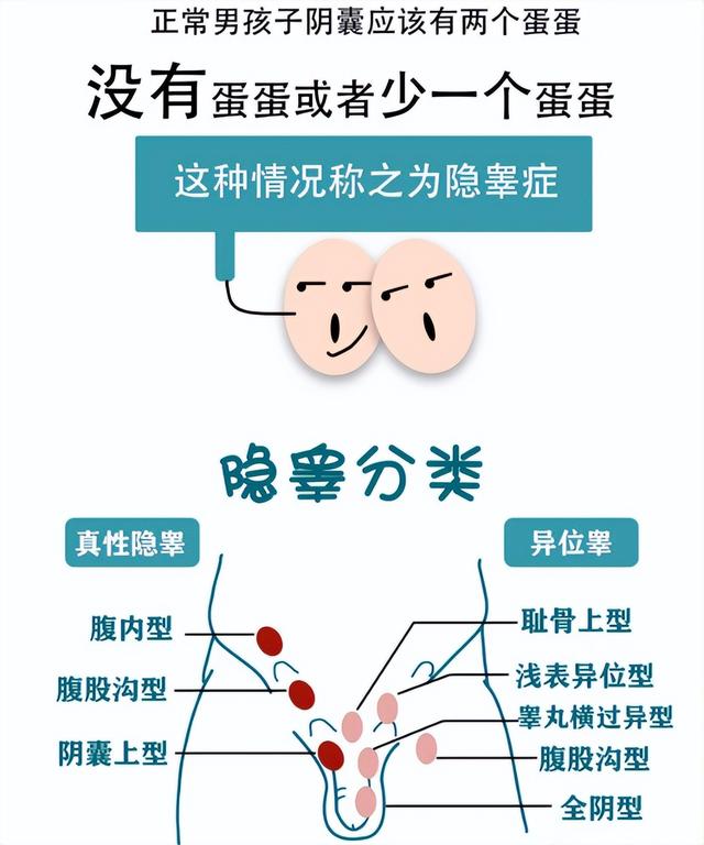 积医科普丨如何应对消失的“蛋蛋”