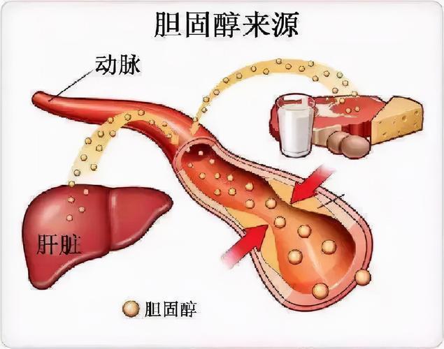 这食物被誉为“胆固醇冠军”，医生：一定要少吃！越吃血管越堵！